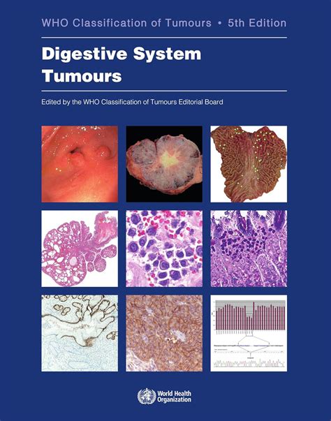 Full Download Digestive System Tumours By Who Classification Of Tumours Editorial Board
