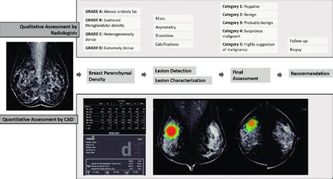 Digital Breast Imaging Workflow - PubMed