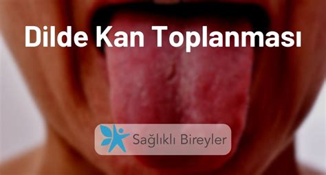 Dilde Onlyfans Leak