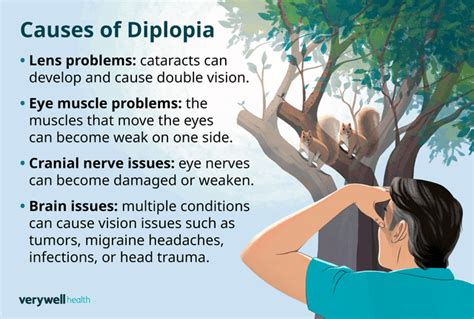 Diplopia or Double Vision Causes and Treatments - Verywell Health