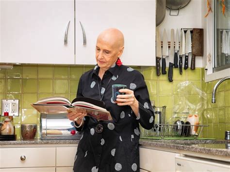 Direct and Hidden Costs with Alopecia Support and Resources