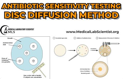 Direct disk diffusion susceptibility testing from respiratory tract ...