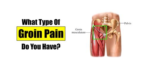 Discomfort in groin when walking