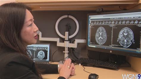 Disconnecting part of the brain helps kids with rare form of epilepsy