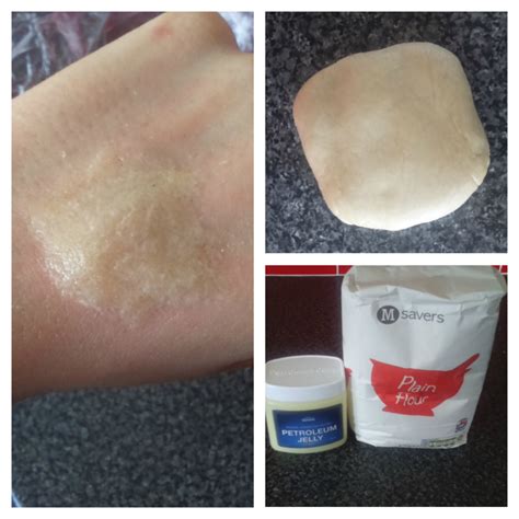 Discover scar wax without flour