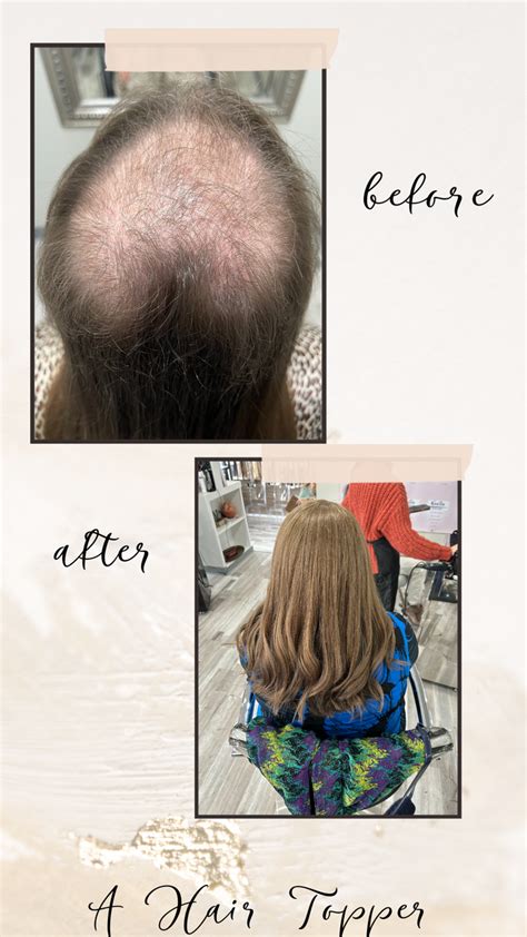 Discover the Transformative Power of Thinning Hair Toppers: Before and After