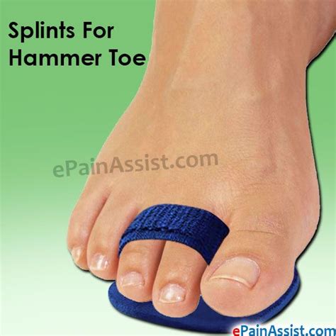 Discover the Ultimate Solution for Hammer Toes: Find Shoes That Fit!