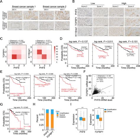 Disrupting PHF8-TOPBP1 connection elicits a breast tumor …