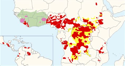 Distribution of Onchocerciasis Showing Current Status of Global ...