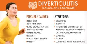 Diverticulitis Diet Nancy Guberti, M.S., C.N.