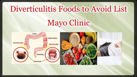 Diverticulitis diet mayo clinic. This liquid diet is also called a “diverticulitis diet.” You start by drinking only clear liquids, such as water, broth, non-pulpy ... Cleveland Clinic: “Diverticular Disease.” Mayo Clinic ... 