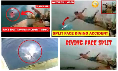 Diving split face accident full video. By Admin September 3, 2022. Everyone, good evening. You’ve probably heard about the recent page split diving incident. According to the majority of websites, it occurred in the Lebanon region. In the video, we see a 16-year-old man attempting to commit suicide by jumping from a certain height, but he slips. He falls approximately 30 feet and ... 