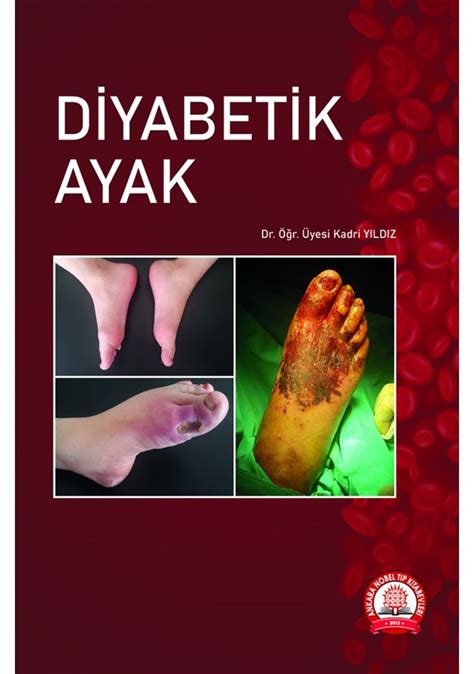 Diyabetik ayak brosur