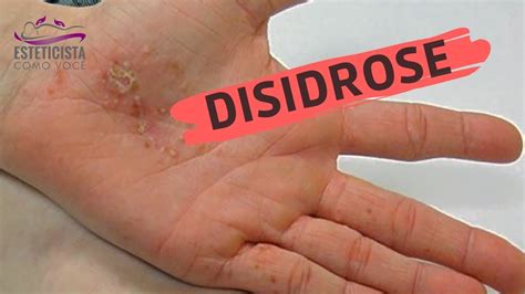 Dizinharosado Leaks (SEX) 🍌 206 Pics