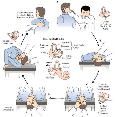 Dizziness, Vertigo, and Imbalance Treatment & Management