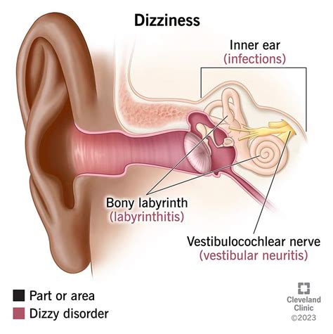 Dizziness and vomiting and sweating. .  Inner ear issues can cause dizziness...