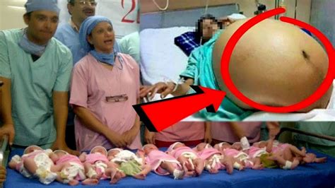 Doğurmuş kadın vajinası