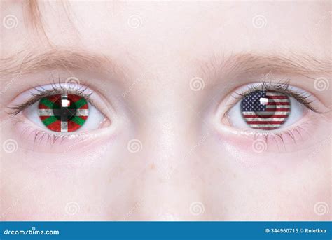 Do Basque have blue eyes