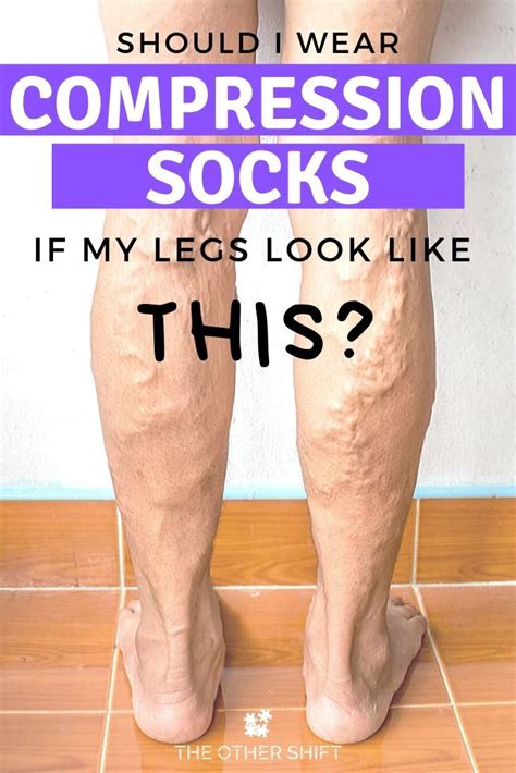 Do Compression Stockings have to be worn on both legs?