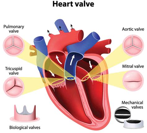 Do I have a serious valve condition that will require surgery?