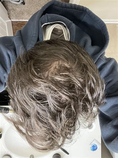 Do I have diffuse thinning in my hair? : r/Hairloss - Reddit