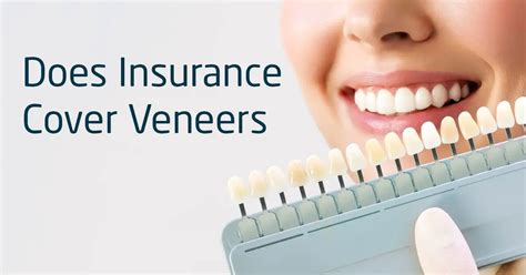 Do Insurance Companies Cover Veneers - All Insurance FAQ