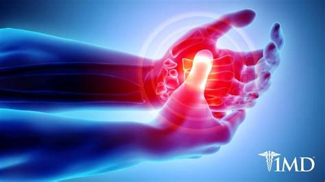 Do Probiotics Relieve Arthritis Pain or Help Prevent Joint ... - 1MD