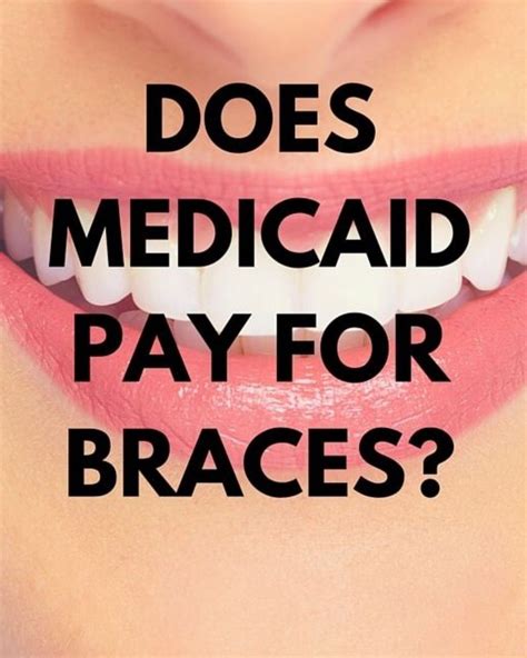 Do medicaid pay for braces. Things To Know About Do medicaid pay for braces. 