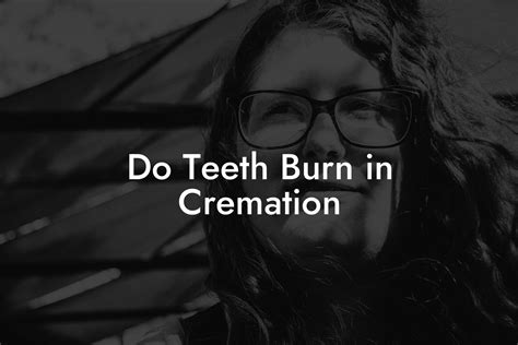Do teeth burn during cremation.  What happens to bones and teeth during cremati...