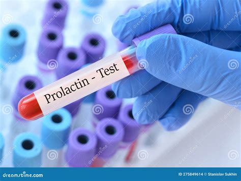 Doctor Holding a Test Blood Sample Tube with Prolactin Test on the