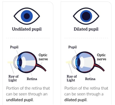 Doe-Eyed: Why Do Pupils Dilate When You Look At Someone You Love …