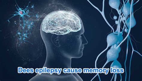 Does Epilepsy Cause Memory Problems 