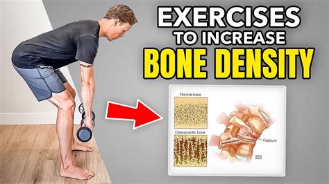 Does Exercise Increase Bone Density 
