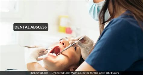 Does Flucloxacillin help in case of a dental abscess? - iCliniq