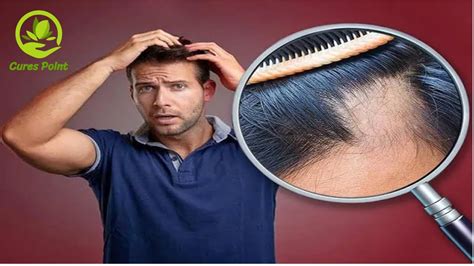 Does Hair Wax Cause Hair Loss Thinning Hair And Hair Wax …