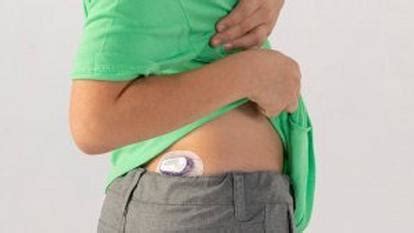 Does anyone wear the Dexcom G6 on their upper butt area?