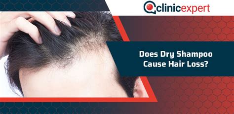 Does dry shampoo cause hair loss. Shampoo and other toiletry products frequently cause allergic reactions. Although shampoos are designed to clean and remove dirt, oils, ... These products’ side effects can include hair loss, dry, brittle hair, a red or dry scalp, itchy scalp, and other discomforts. 