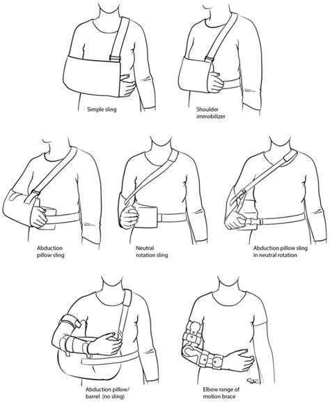 Does immobilization of the shoulder in different ... - ScienceDirect