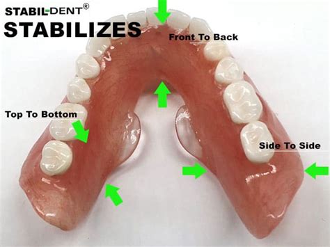 Does stabil dent really work.  Lower Denture Stabilizers specially designed to ke...