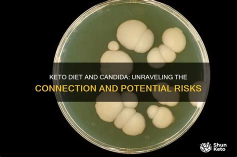 Does the keto diet kill candida. .  <a href=http://stagelogistics.technoglobal.ch/assets...
