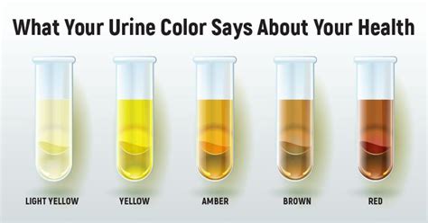 Urine scale is made up of urine sediments that build up in your 