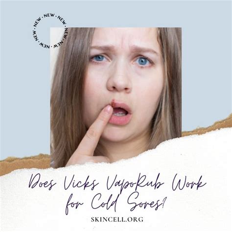 Does vicks work on cold sores. Cold sores respond to medications called antivirals, which work by stopping the herpes virus from replicating. Using the medication as soon as symptoms develop can stop the cold sore from ... 
