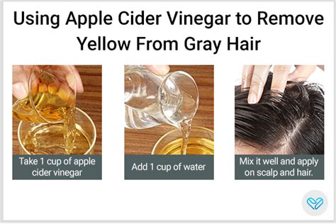 Does vinegar remove yellowing