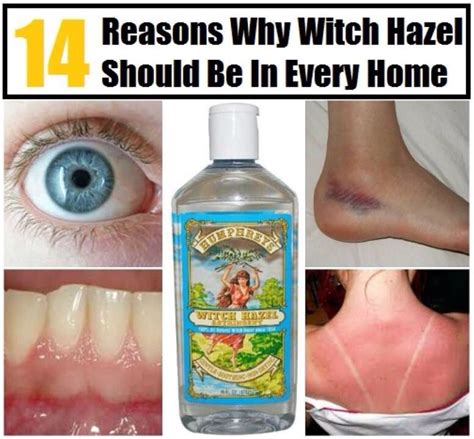No, it isn't a disinfectant. Witch hazel is often distilled for remedies against skin irritation, but it does not kill germs. Ted S. Warren/AP. Witch hazel does not kill germs, including most .... 