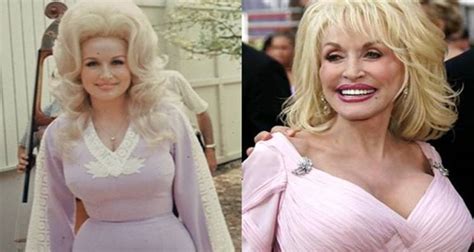 Dolly parton before breast implants. 2 Rhinoplasty Priyanka Chopra. Priyanka Chopra revealed she went through a “dark phase” after a doctor recommended for her to get a nose job. She was advised to a polyp in her nasal cavity ... 