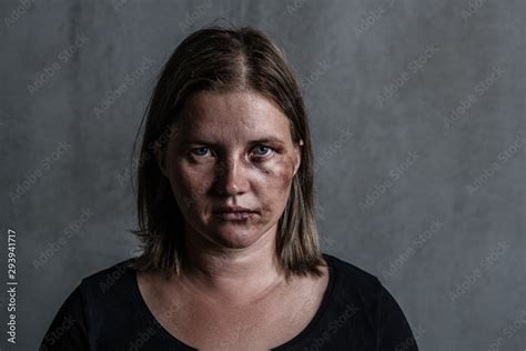 Domestic Violence and Victim