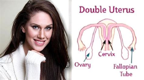 Doppelvaginal
