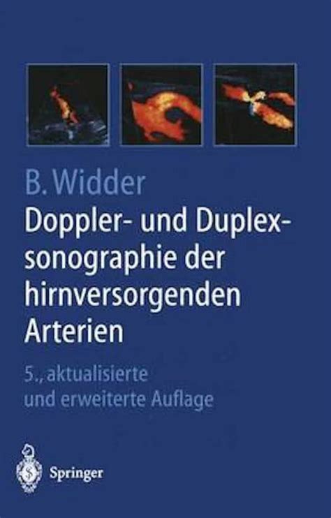 Doppler  und duplexsonographie der hirnversorgenden arterien. - Komatsu d40a d40p 1 d45a d45p d45s 1 dozer shop manual.