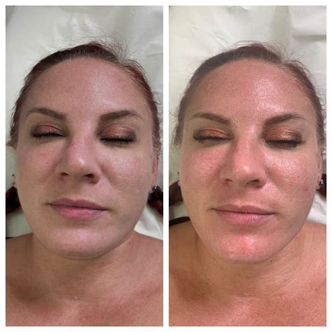 Doubke Facial Onlyfans Leak