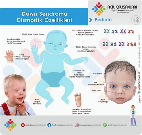 Down sendromlu bireylerin kromozom sayısı